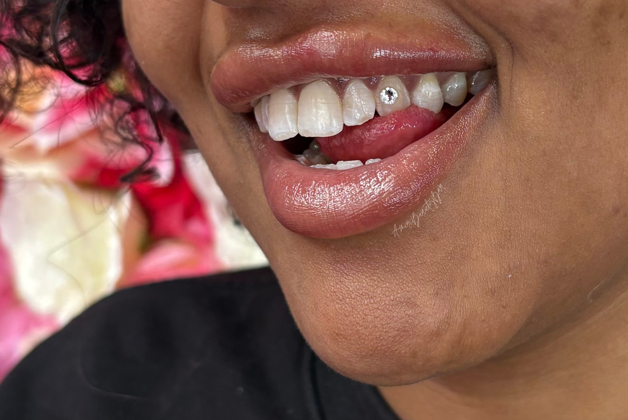 The Ultimate Guide to Tooth Gem Longevity: Why Some Last 3 Weeks and Others Over A Year